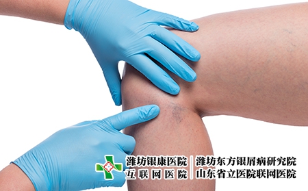 攝圖網_303522806_醫(yī)生親手檢查女腿和緊閉的容器上變血管（企業(yè)商用）關節(jié)